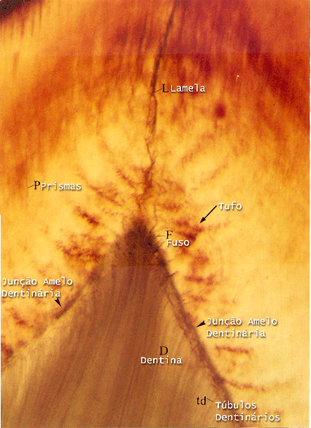 Junção amelo-dentinária sob luz transmitida